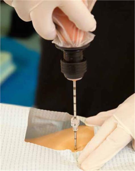 On Control Bone Marrow Biopsy and Aspiration System