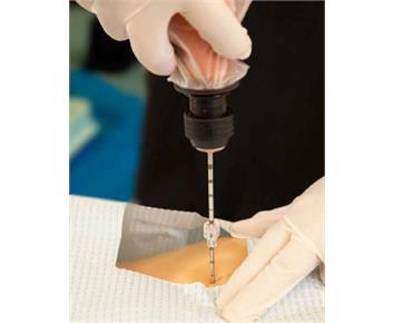 On Control Bone Marrow Biopsy and Aspiration System